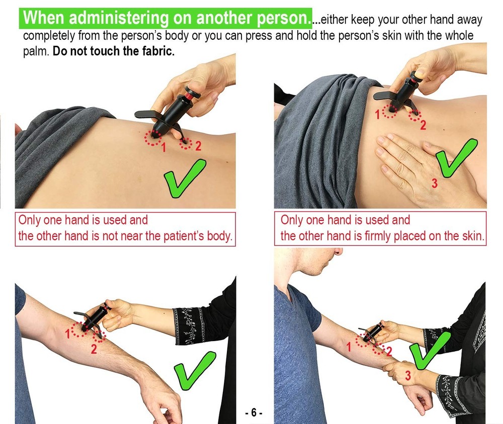 Trigger Point Stimulator Tool - Electric Current Sensation No Needles No Battery