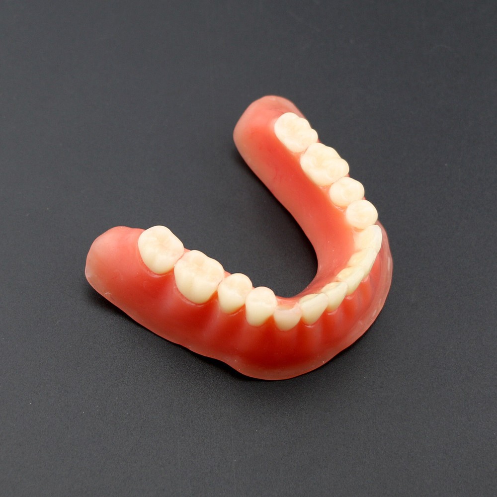 Dental Teeth Model Inferior Overdenture Precision 4 Implants Demo Silver Bar