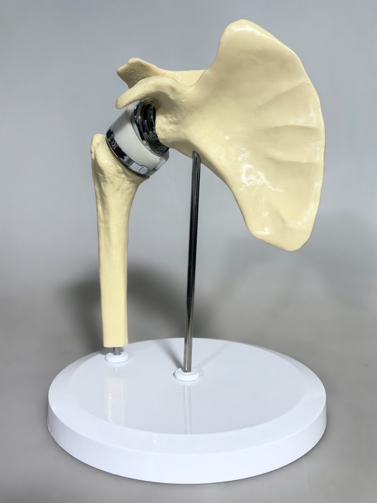 Artificial Shoulder Replacement Anatomical Model Knee Shoulder Elbow Joint Model