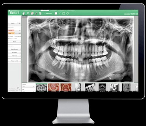 Vatech Ezdent-i & Ez3D-i Software w/ 10 license keys