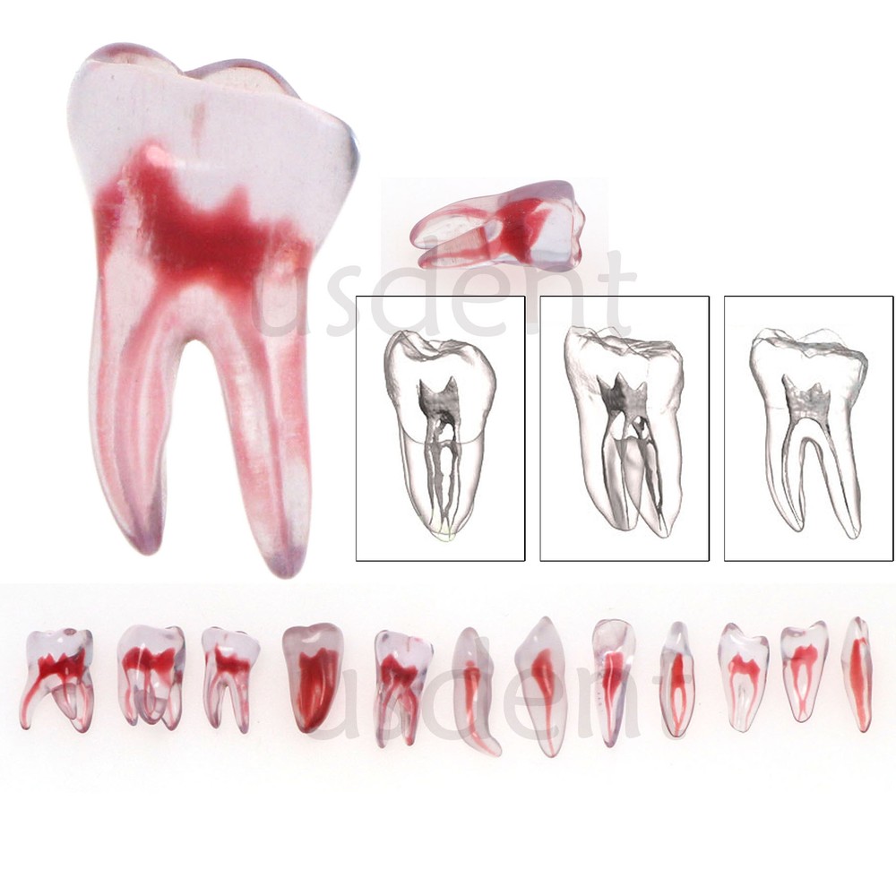 Dental Resin Study Endo Root Canal Teeth Model Practice Block RCT Pulp Cavity