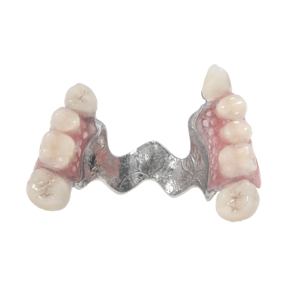 Dental Overdenture Typodont Teeth Model Telescope Crown Prosthetics Model M6010
