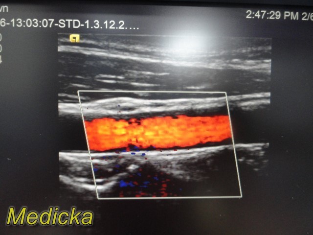 2013 Siemens 9L4 Linear Array Ultrasound Transducer Ref 10035946 ~ 39512