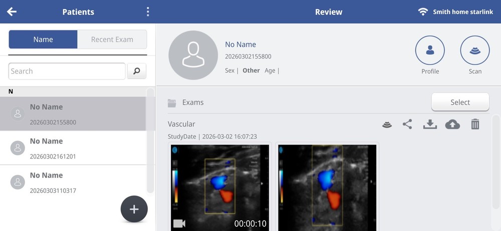 SONON 300L Linear Array Wireless Ultrasound Probe Device