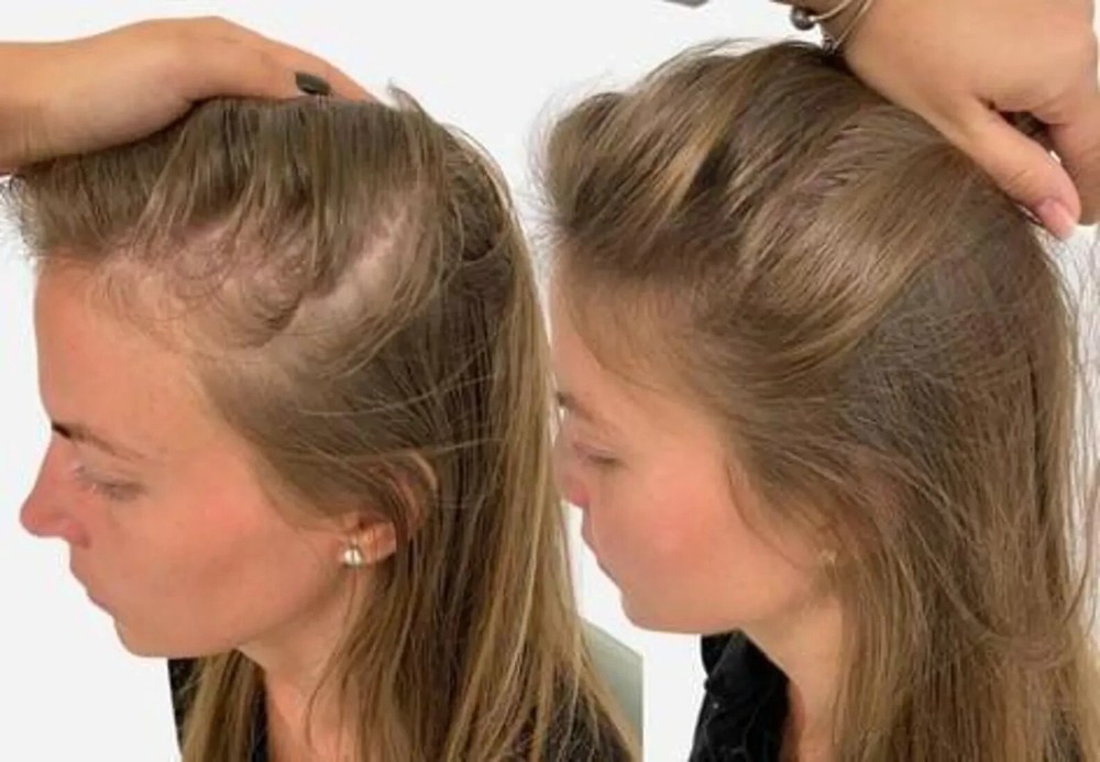 Hair Increase Spell