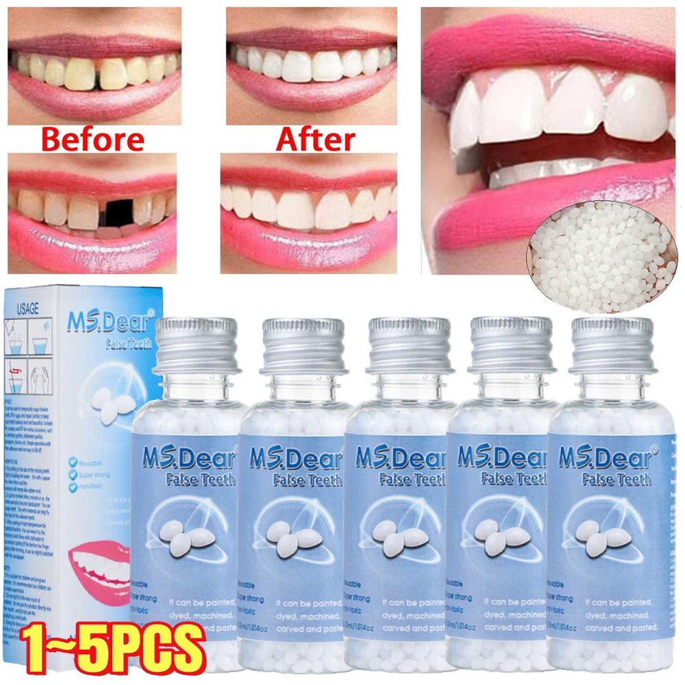 Tooth Repair Granules Temporary Kit Fitting Beads Reusable Moldable False Teeth