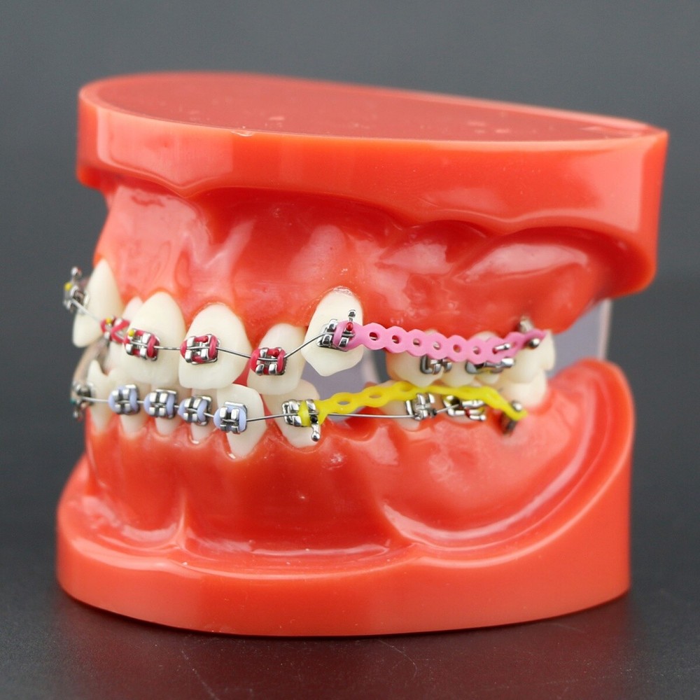 Dental Teeth Teaching Model Orthodontic Model Metal Arch Ceramic Brackets