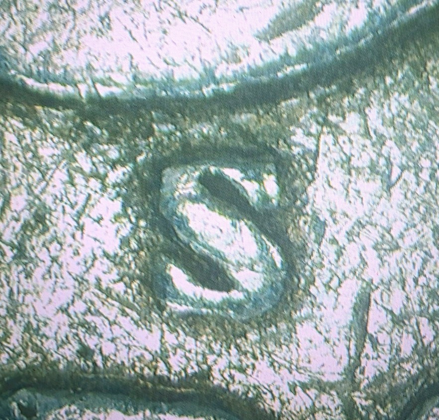 1911-S S/S Barber Half Dollar Rpm, Die Gouges On Reverse, G-06 Condition.