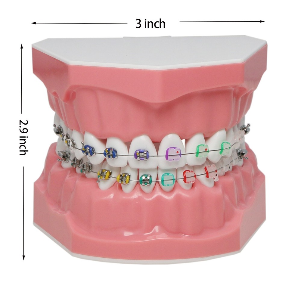 Dental Typodont Teeth Model 1:1 Teach Study Half Metal Ceramic Brackets Tubes