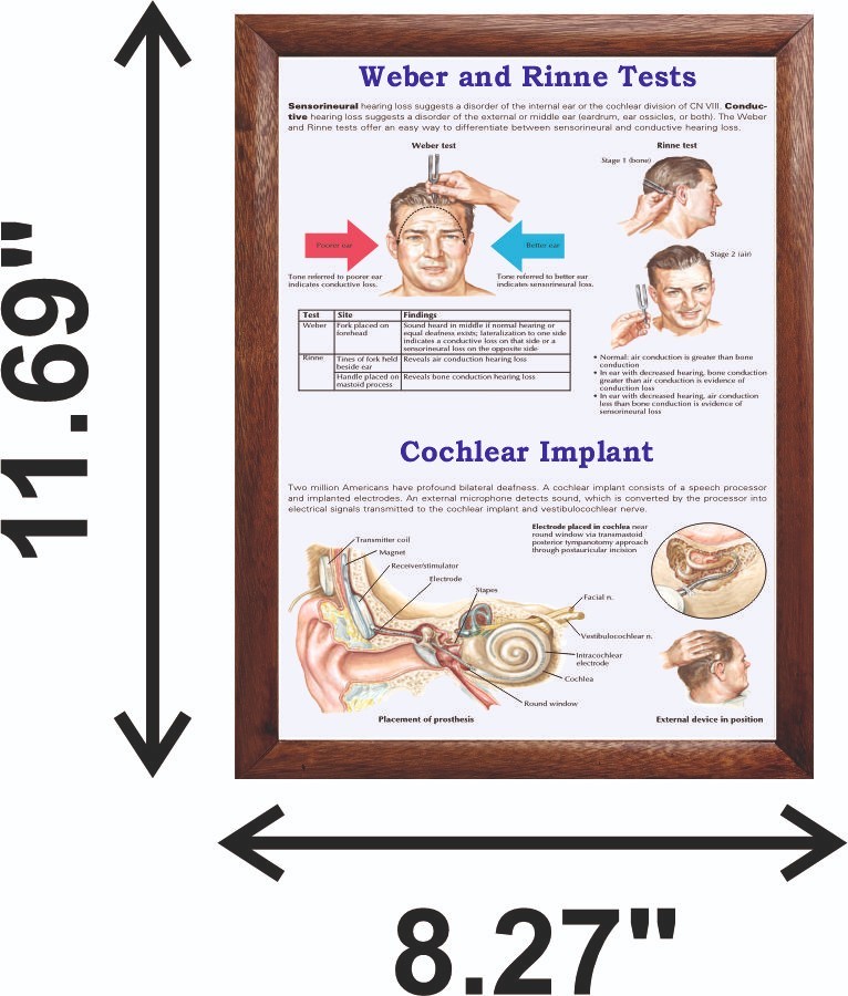 Weber and Rinne Tests Chart 12x18 inches