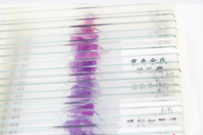 100PCS Mammals Pathology Microscope Prepared Slides Set Specimen