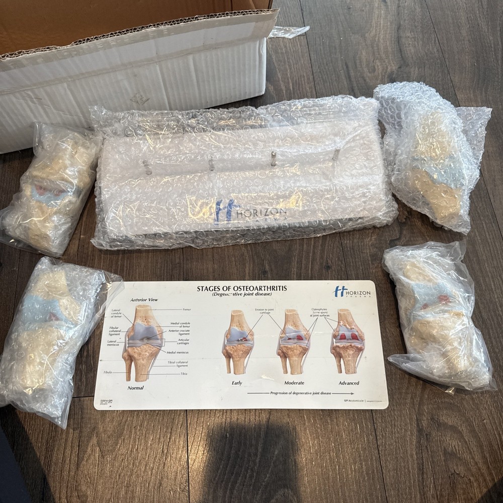 Knee Joint Osteoarthritis GPI  Model Set horizon pharma