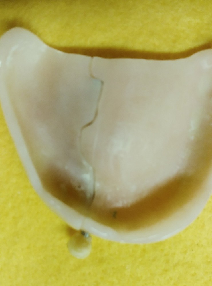 Devided Denture DENTAL DEMONSTRATION TEACHING MODEL Lab Dentist & Oral Surgeon
