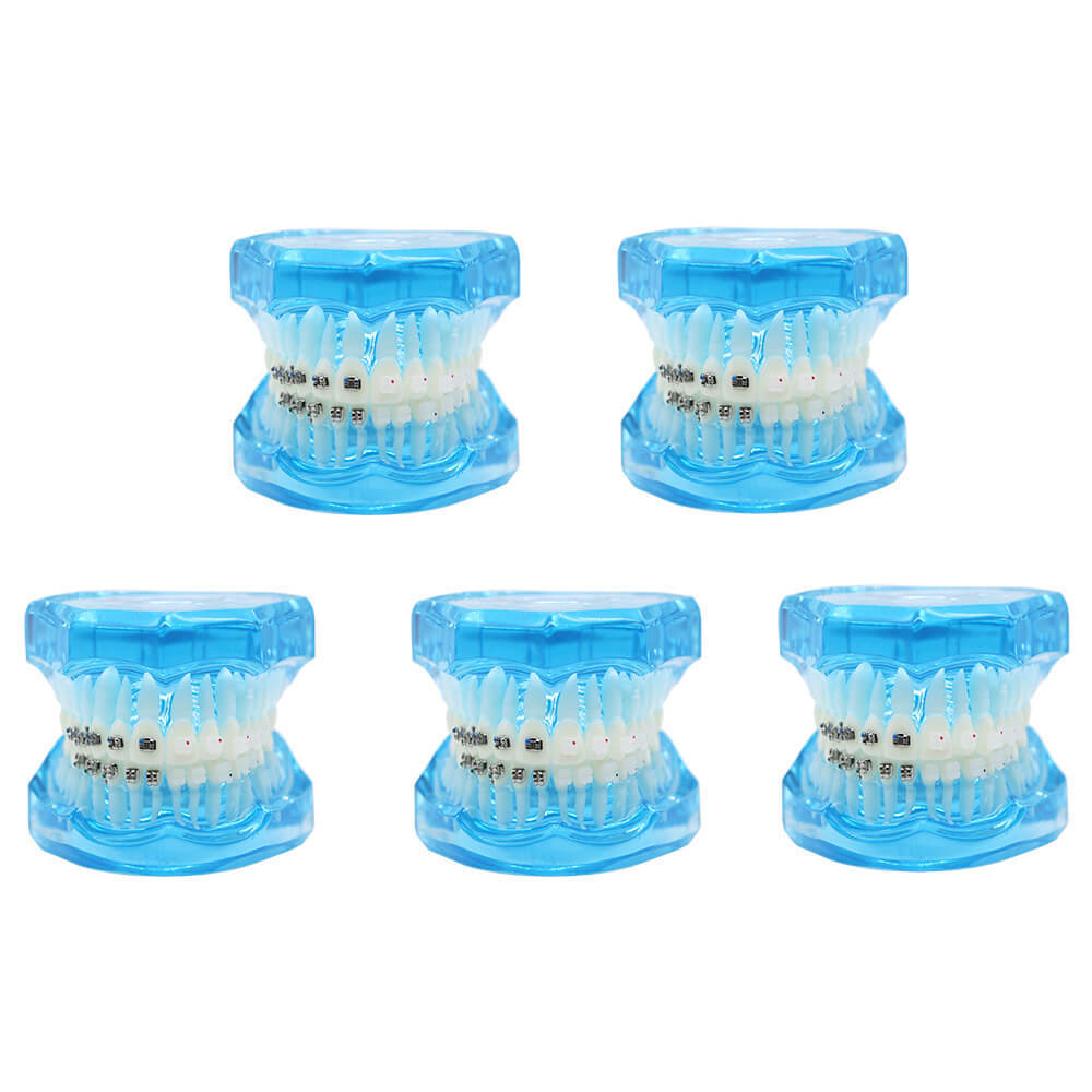Dental orthodontic teach study teeth model mental and ceramic bracket contrust
