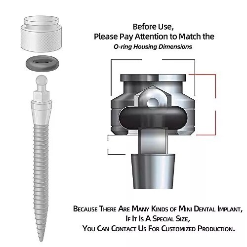 O-Ring Buna-N Tool Kit with 3 Convenient Sizes for Mini Dental Implants