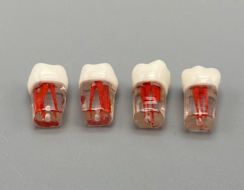 5pcs Dental Root Canal Teeth Study Practice Model Endodontic RCT Endo Pulp File