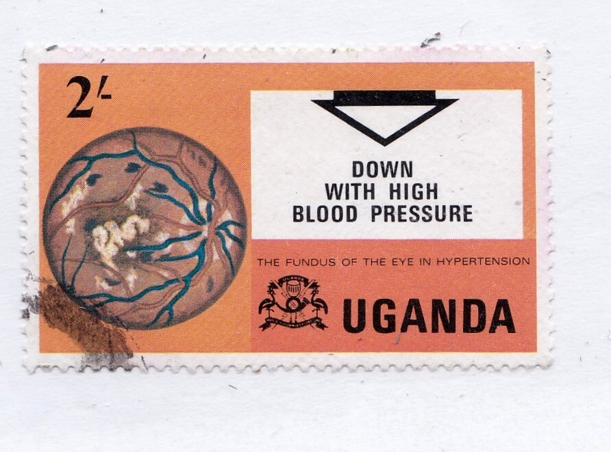 Uganda       209           used