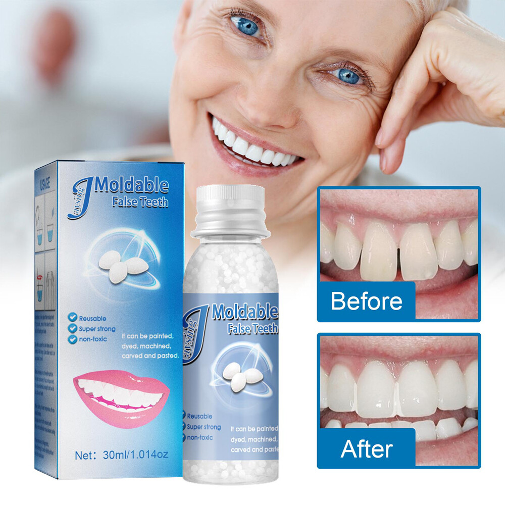 UK Tooth Repair Kit Temporary Teeth Replacement Beads for Missing & Broken Teeth