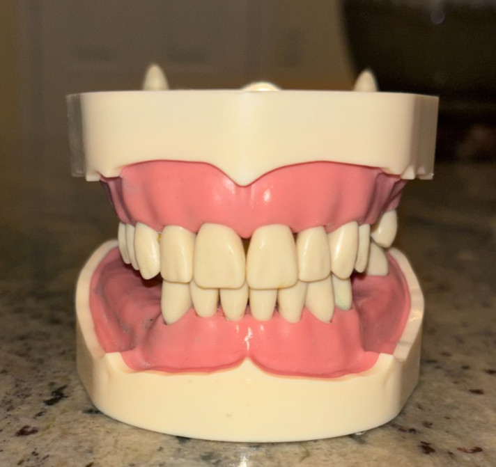 RPD/Partially Edentulous Typodont