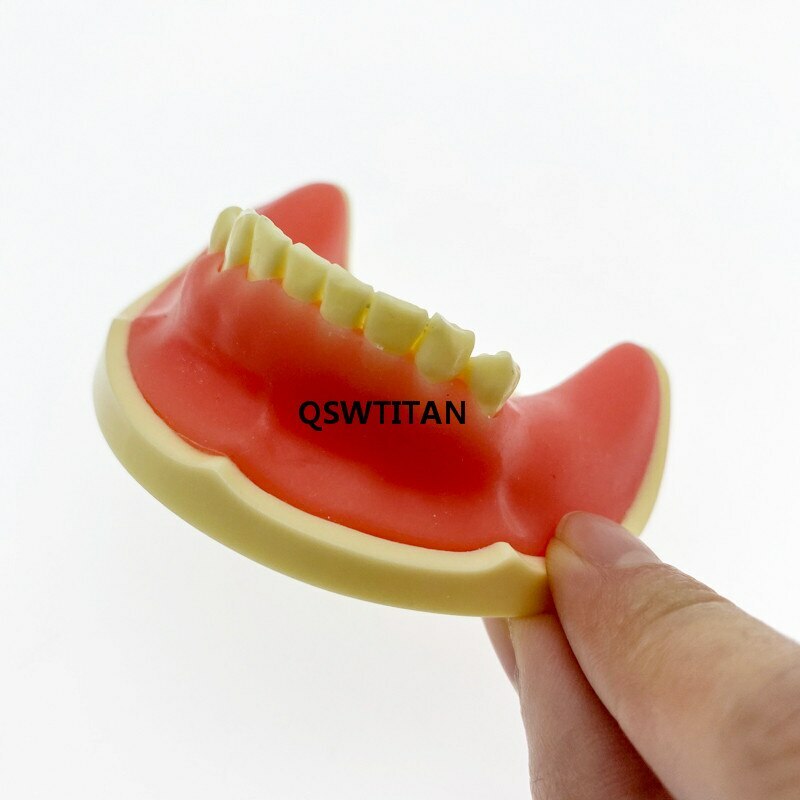 Teeth Model Implant Practice For incision drilling Practices Dental Study Model