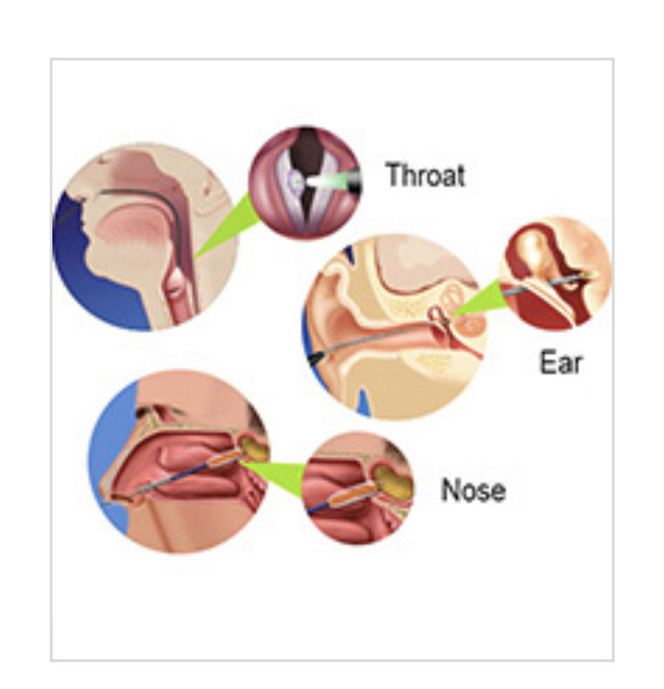 1x dental laser Diode soft tissue laser
