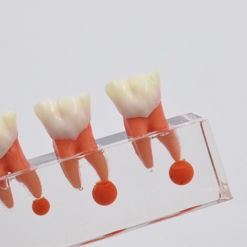 Dental Study Teaching Model Periodontal Caries Disease Teeth Dentoform Typodont