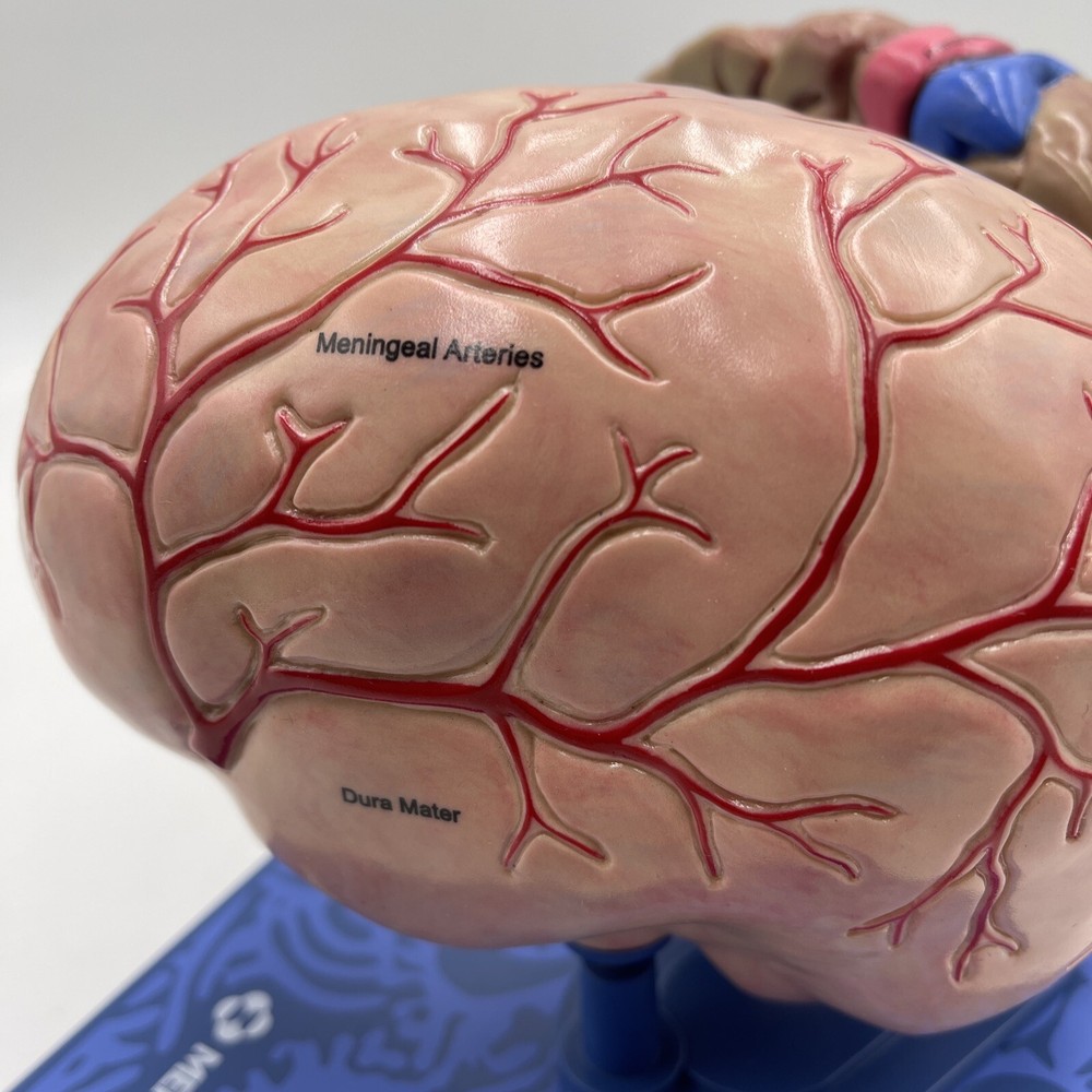 Maxalt Brain Anatomical Model Migraine Pathology Education Teaching Model