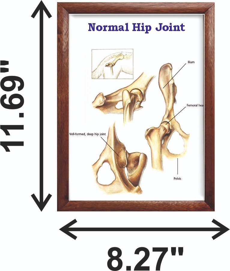 Normal Hip Joint Chart 12x18 inches