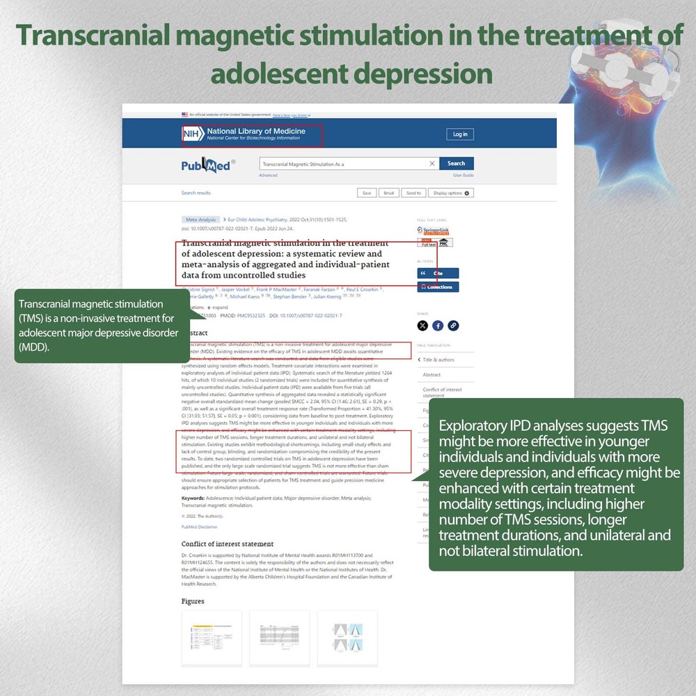 TMS Brain Stimulation Device with 50Hz Peak Frequency for Bipolar Panic Support