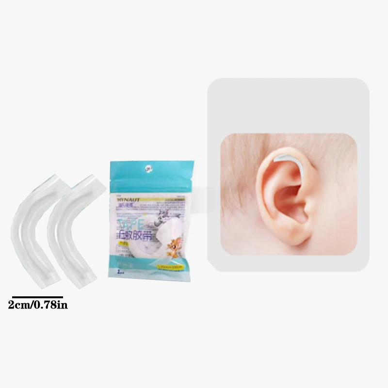 Protruding Ear Support Infant Corrector Tools Silicone Auricle Correction Patch