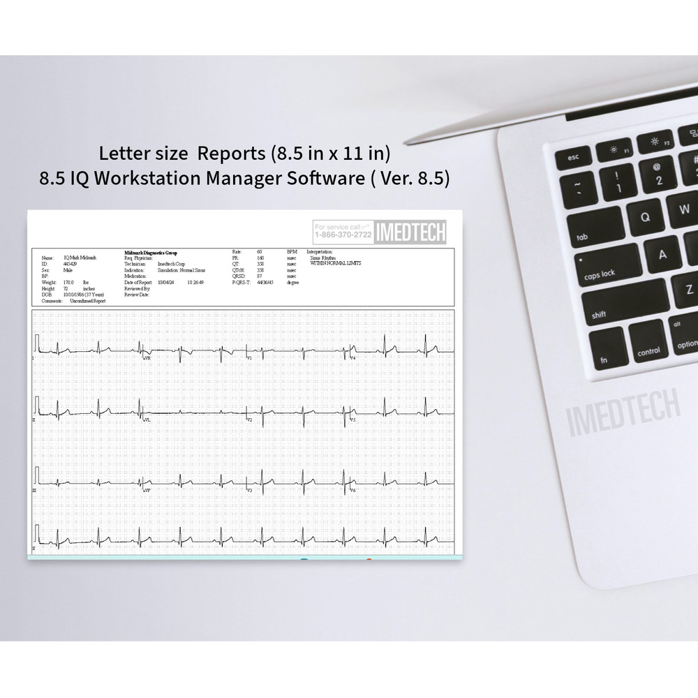 Midmark IQecg ECG Digital Interpretative eClinicalWorks Integration