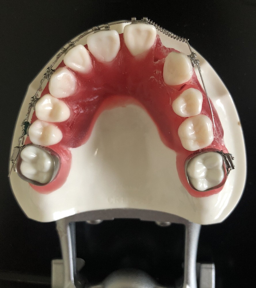 Nissin Ortho Typodont Dental Model