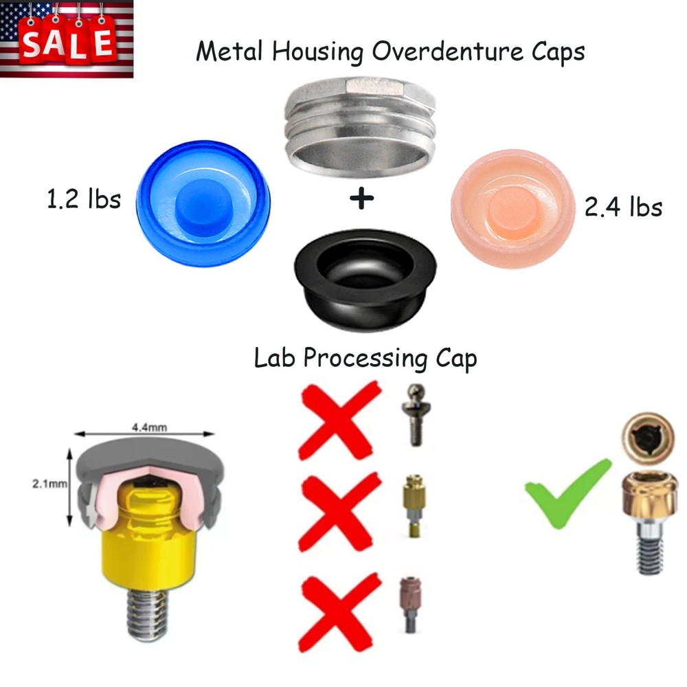 US Locator Overdenture Abutment System Retention Cap Kit and Accessories Inserts