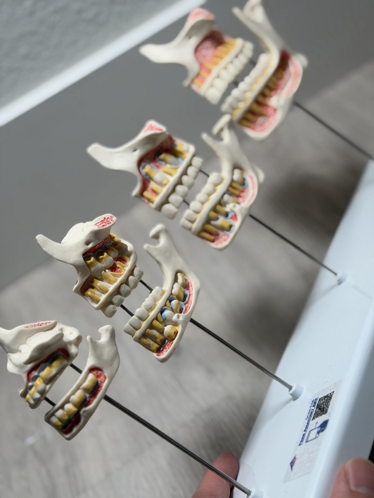 3B Scientific Dentition Development Model - 4 Stages Dental Teeth education