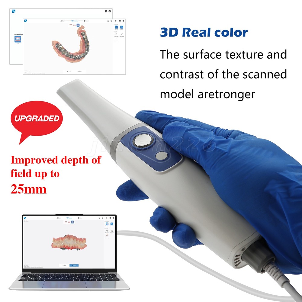 Dental Intraoral Scanner /Scanning Tip & Cable