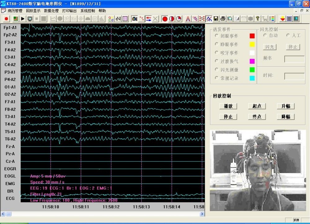 Professional 24-Channel EEG Brain Mapping Software | KT88-2400 System