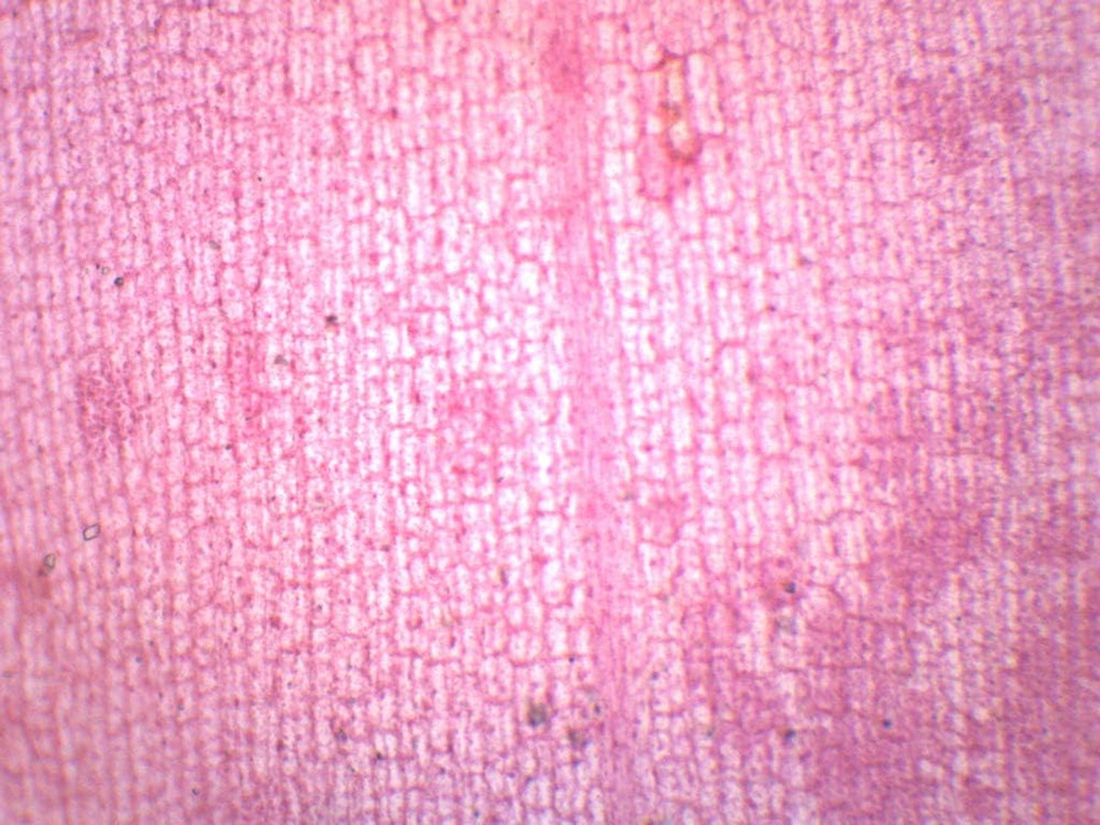 Elodea, Submerged Leaf - Prepared Microscope Slide - 75 X 25Mm - Microscopy