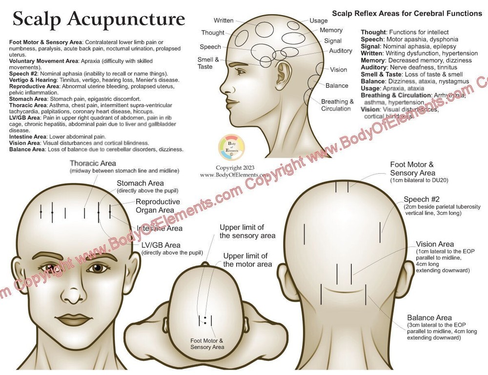 Scalp Acupuncture Points Chart 8.5" X 11" Head Microsystem