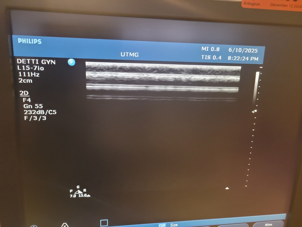 PHILIPS L15-7IO LINEAR ARRAY ULTRASOUND TRANSDUCER PROBE EXCELLENT CONDITION