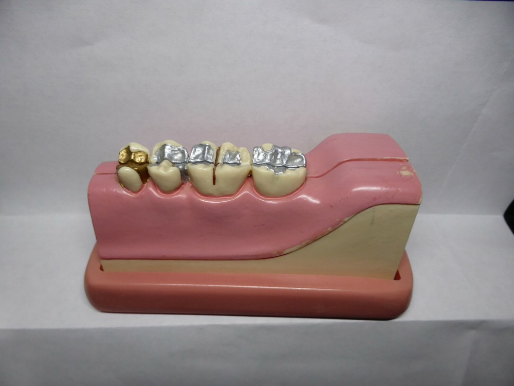 Typodont, Common Dental Pathologies Model, Patient instruction, x- section