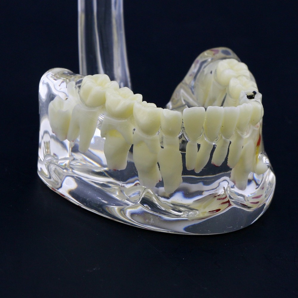 Dental Children Pediatric Pathology Demonstration Study Tooth Teeth Model 4002