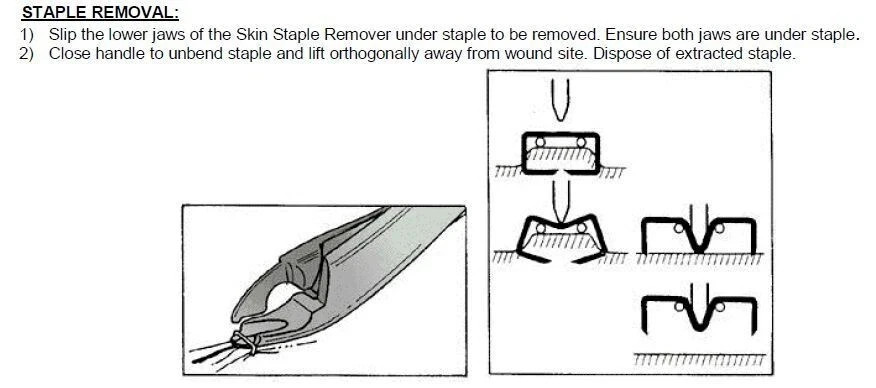 Surgical Skin Staple Remover Beige Handle