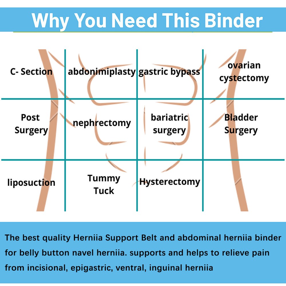 Umbilical Hernia Belt - Unisex - Abdominal Support Binder with Compression Pad