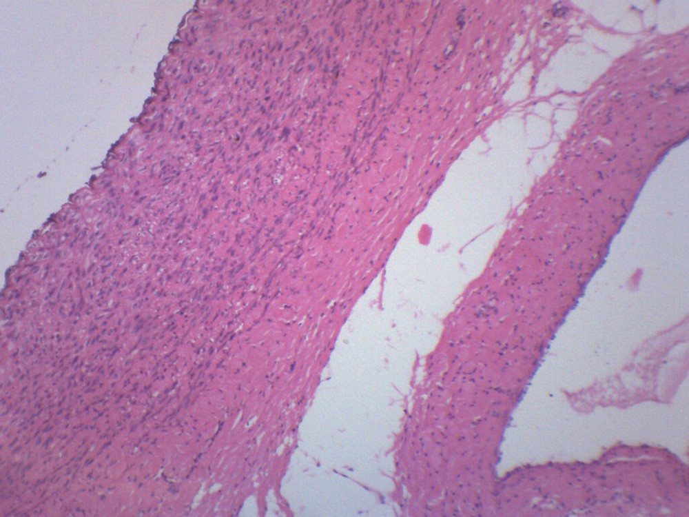 Human Artery & Vein, Prepared Microscope Slide - 75x25mm - Eisco Labs