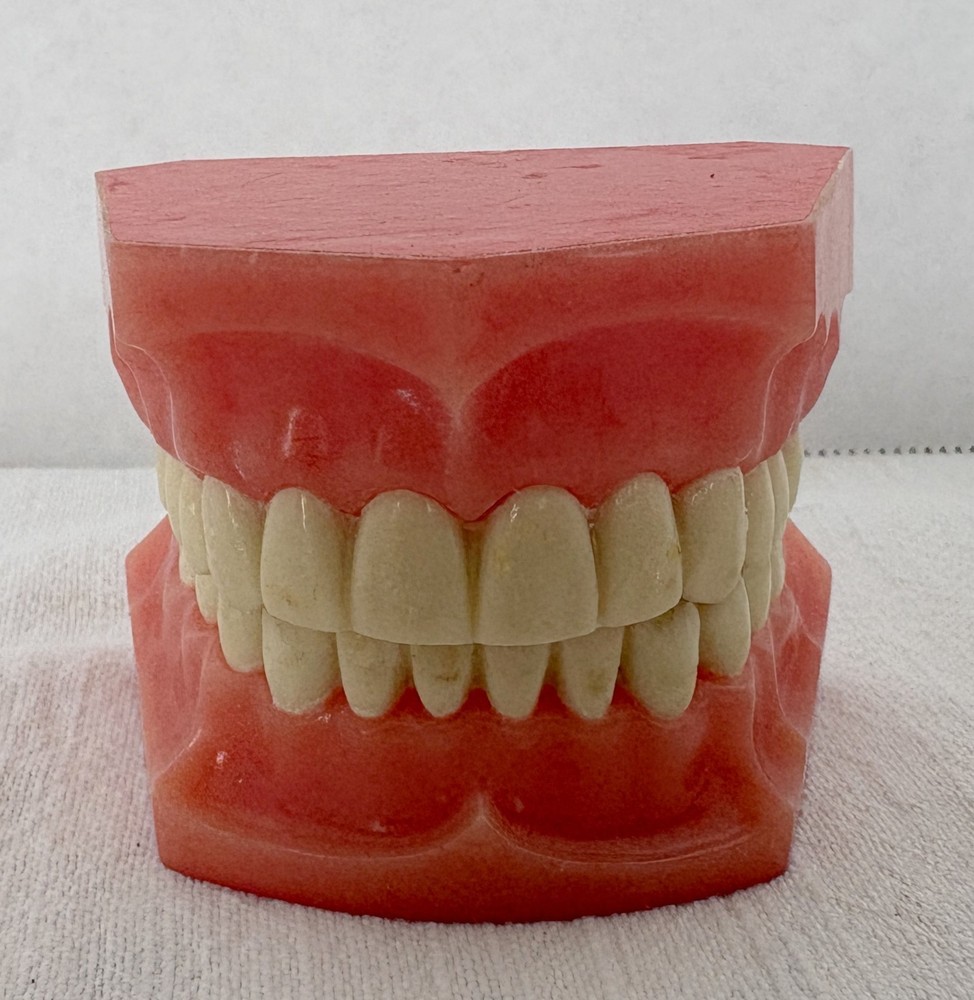 Vintage Dental Model for Teaching or Demonstration