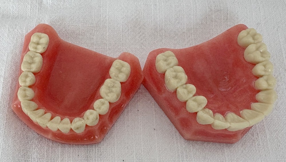 Vintage Dental Model for Teaching or Demonstration