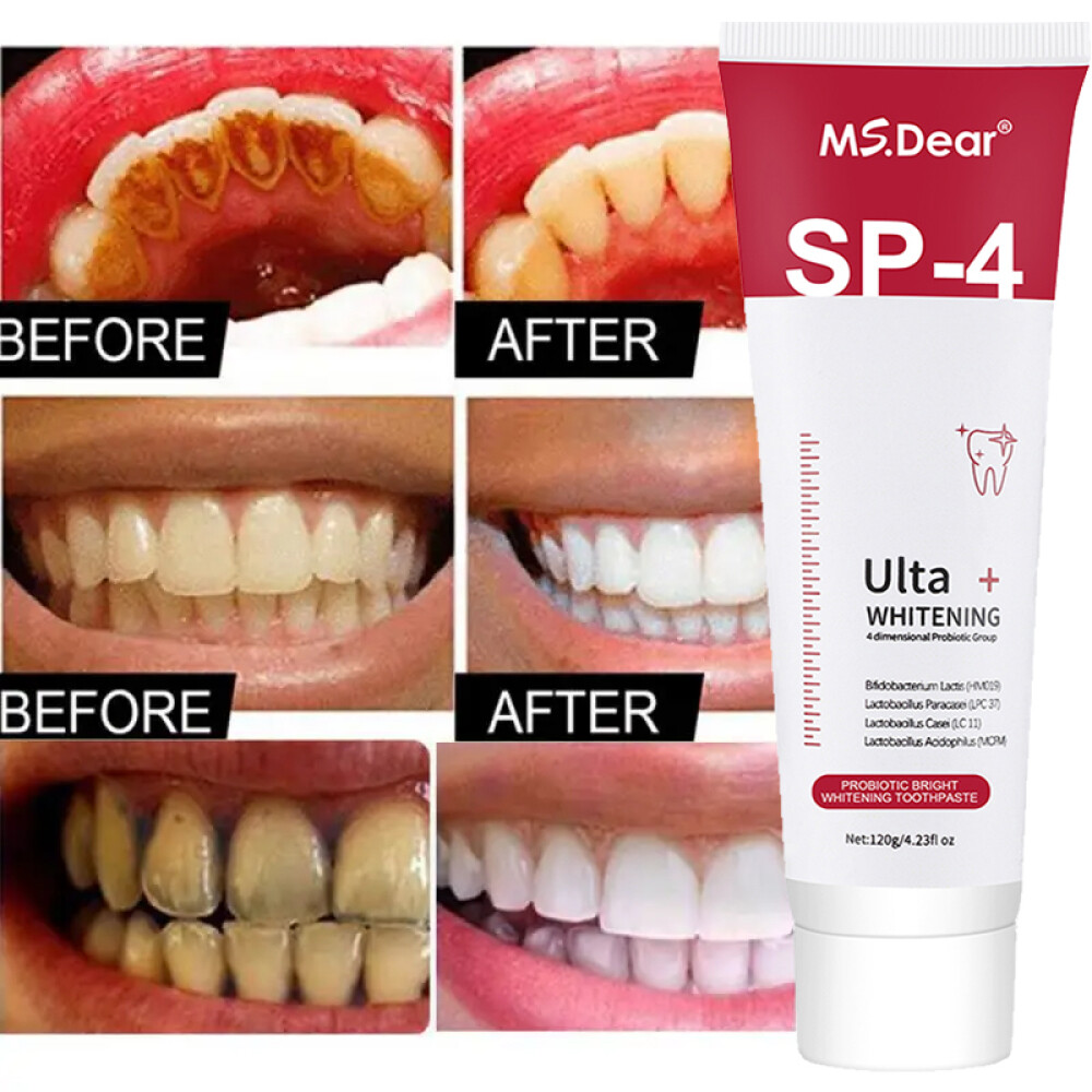 Sip-4 Toothpaste, Whitening Sp-4 Toothpaste, Sp-4 Probiotic Whitening Toothpaste