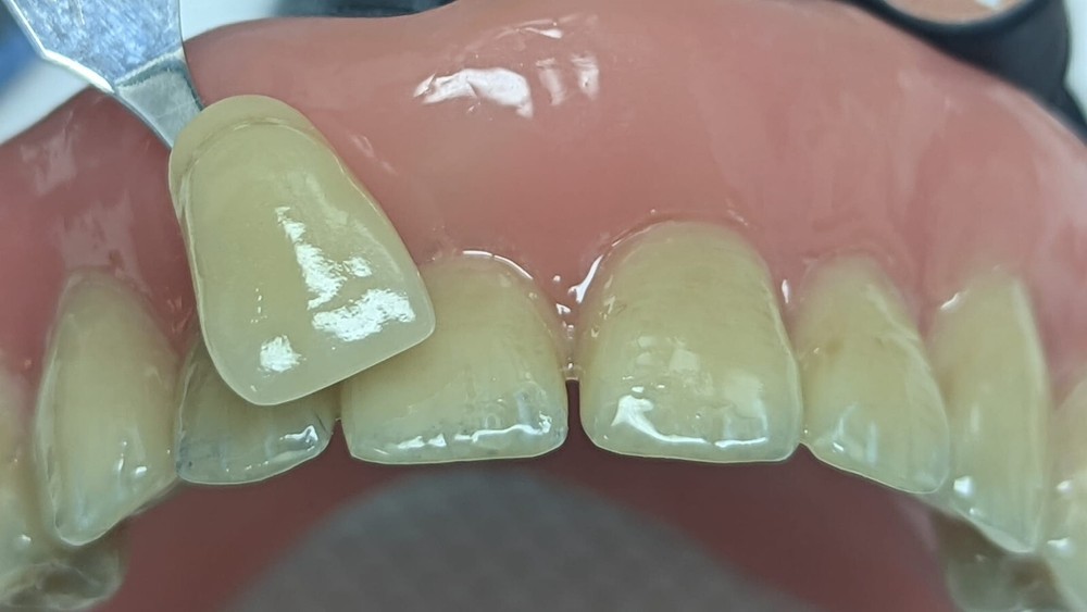 DLP SLA LCD 3d printer denture base resin for manufacturing dentures