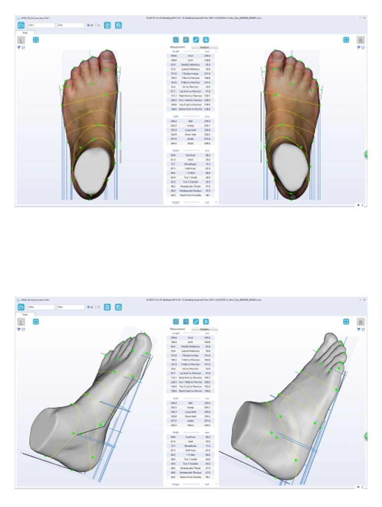 UPOD 3D Foot Scanner