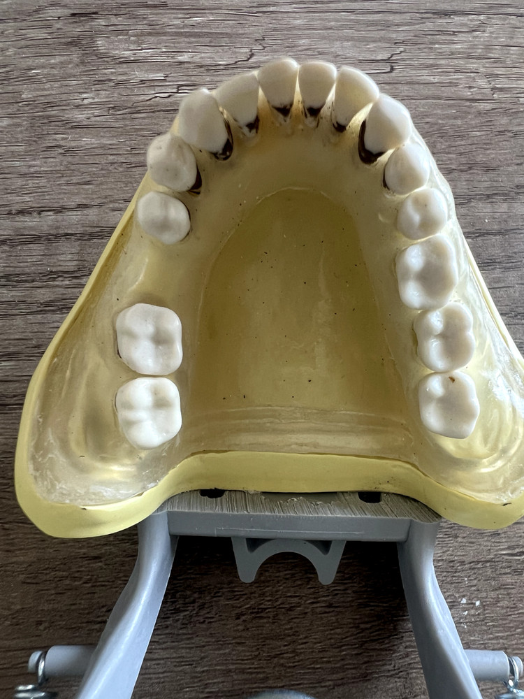 Nissin Periodontal Typodont Includes Both Upper And Lower Arch